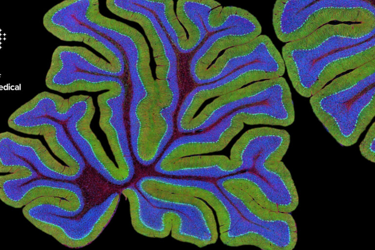 Reforming Human Tissue Laws